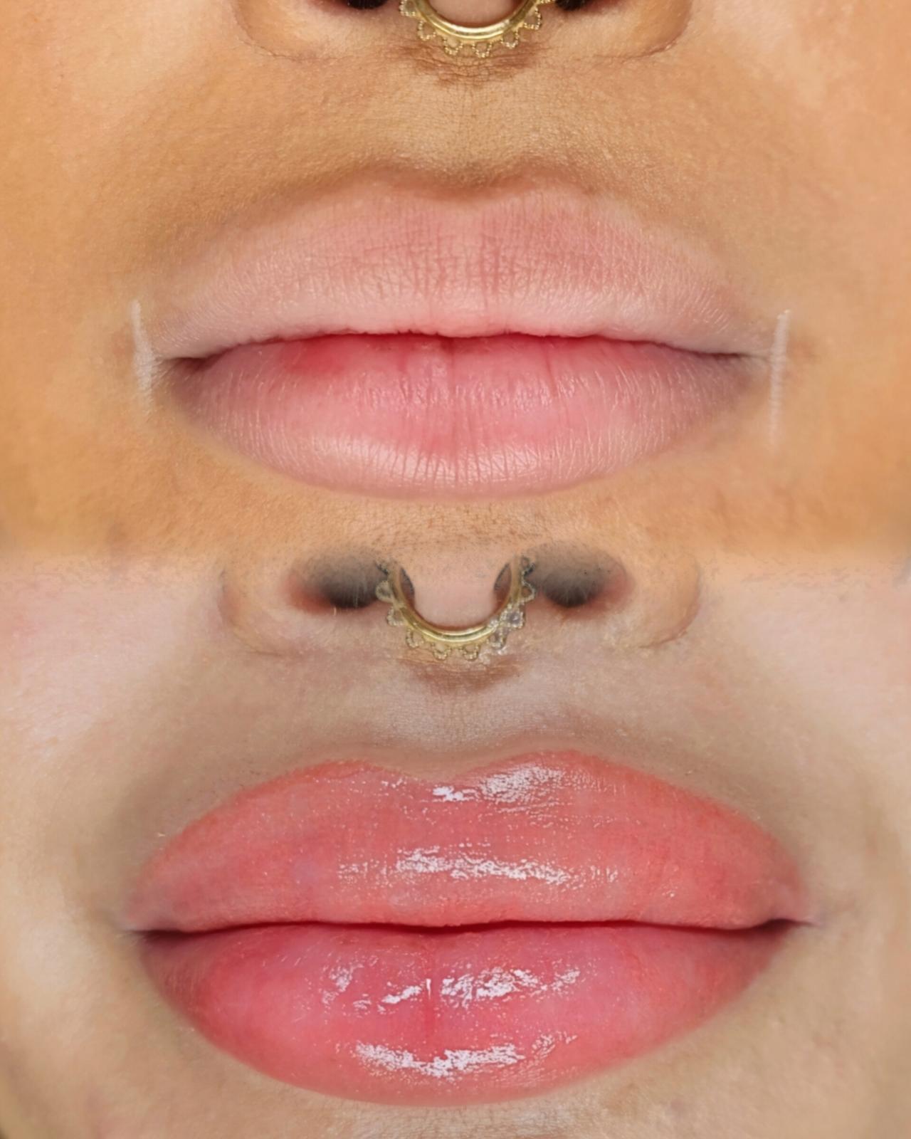 unnamed image